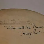 Banjo Skin Closeup — Genevieve “Bunny” Longo